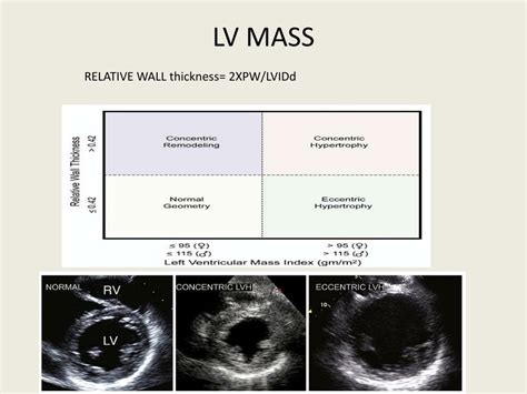 normal Lv mass echo